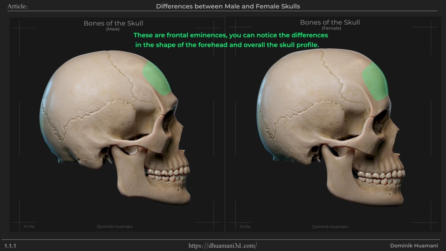 1.1.1_frontalEminence