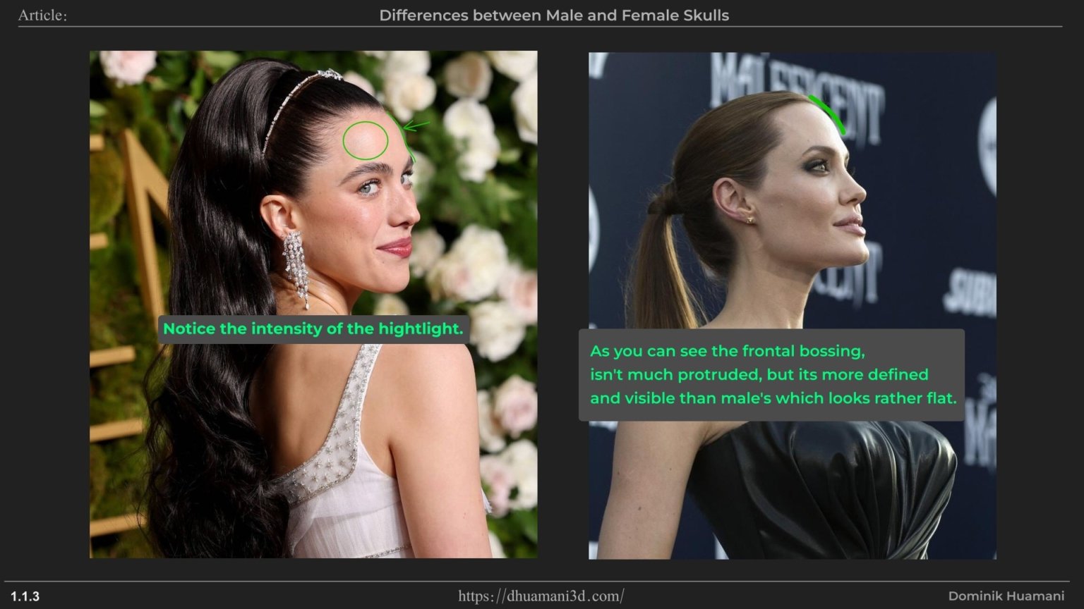 1.1.3_frontalEminence