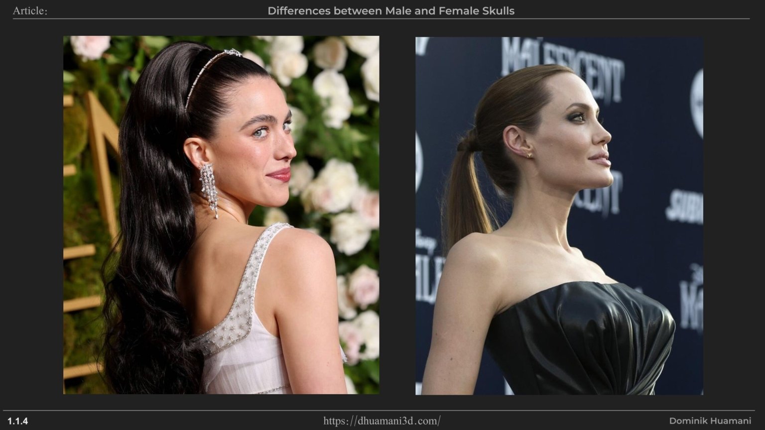 1.1.4_frontalEminence