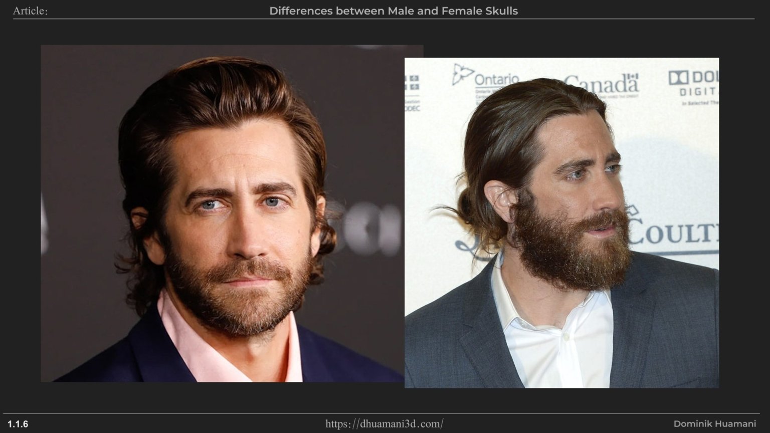 1.1.6_frontalEminence