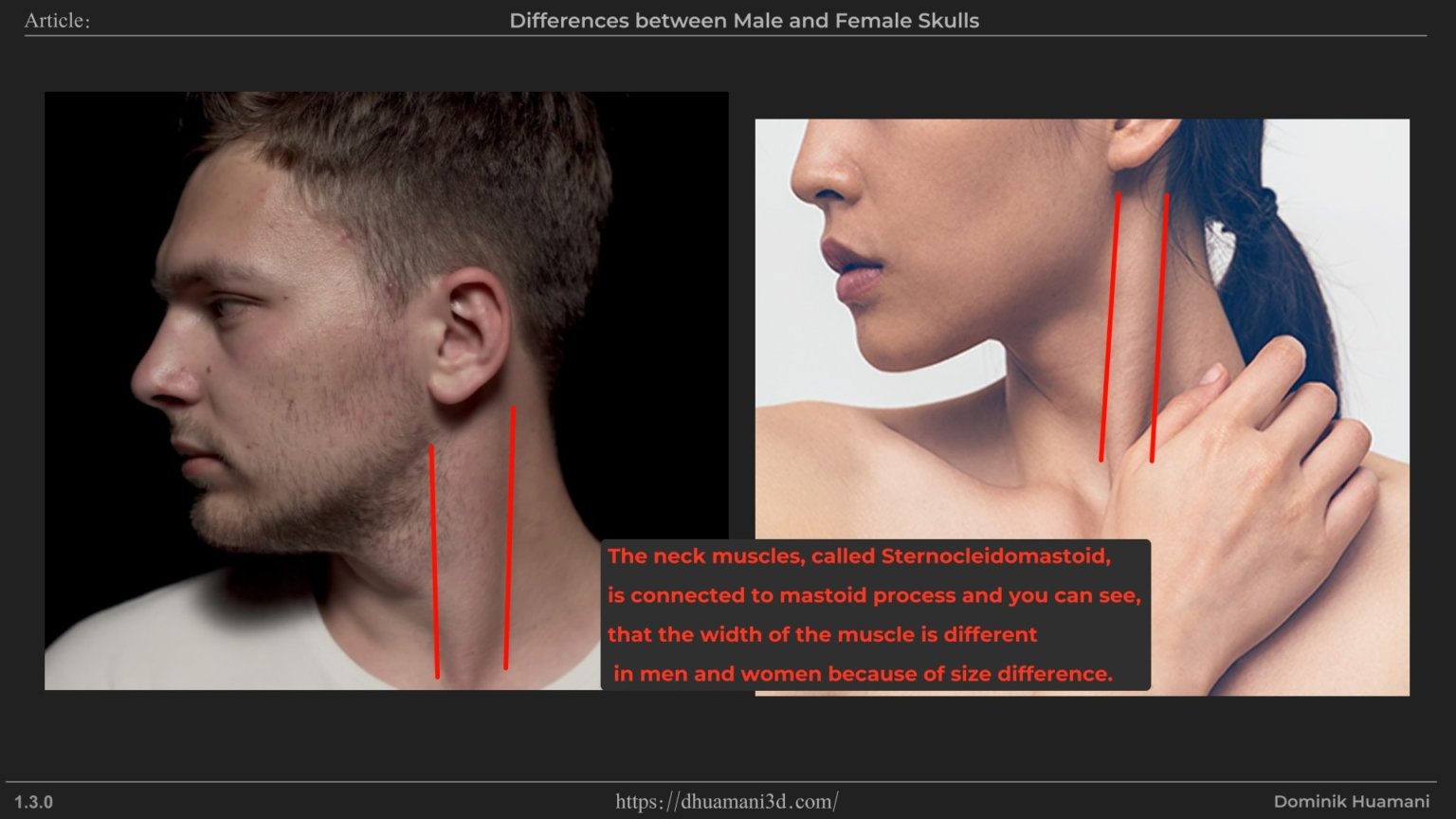 1.3.0_mastoidprocess