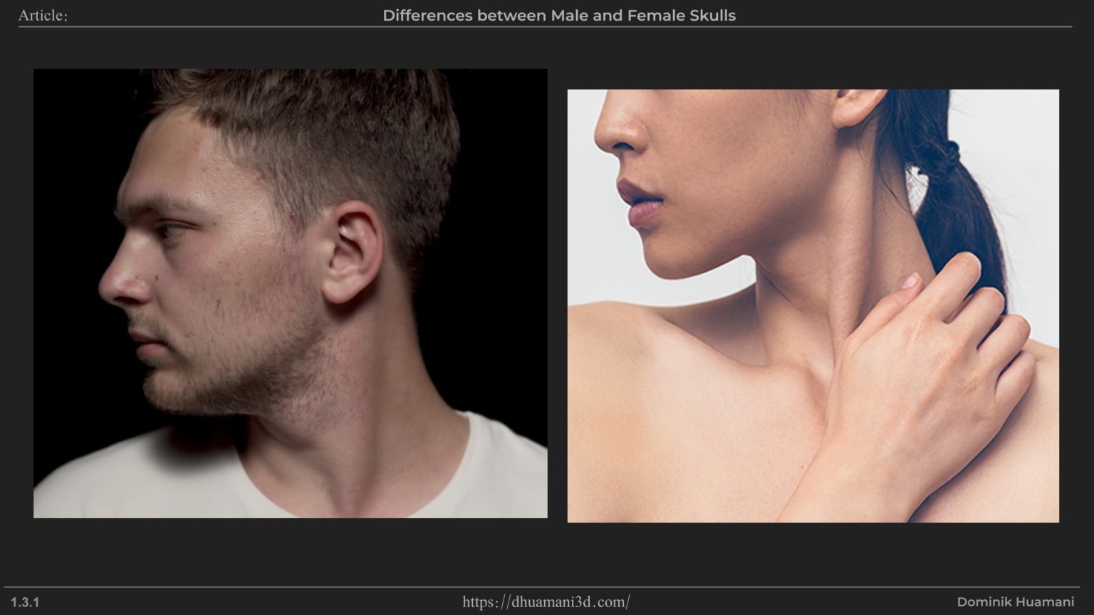 1.3.1_mastoidprocess